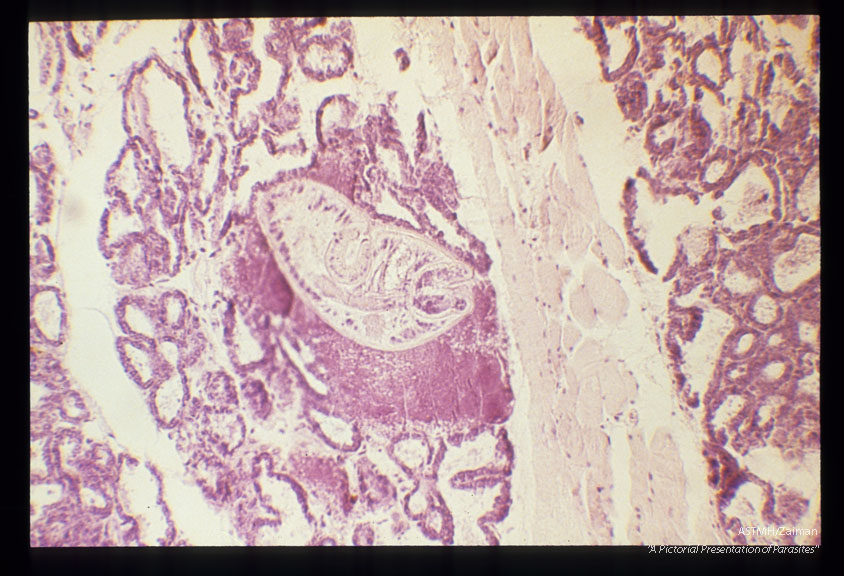 Mesocercaria in a pool of milk after the destruction of several alveoli in the mammary glands.