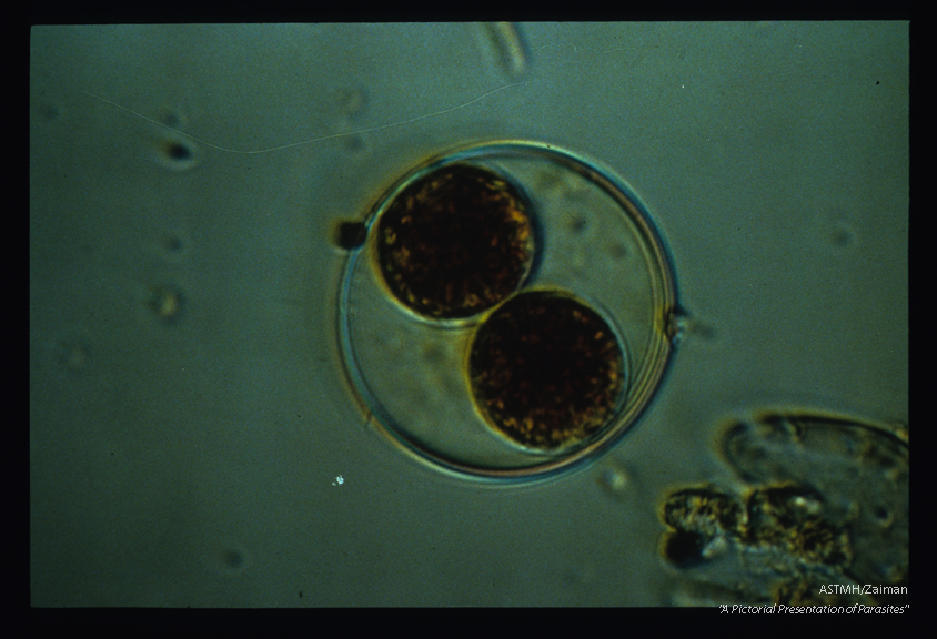 The oocyst has been penetrated by iodine and the two sporocysts stained.