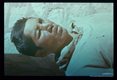 Bolivia. Mucocutaneous destruction.
