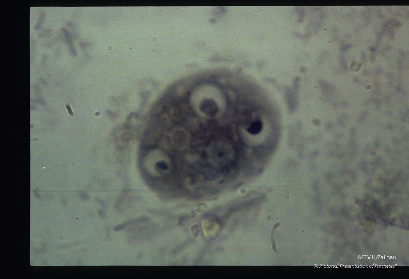 Trophozoite. Iron hematoxylin stain.