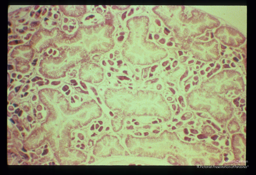 Daughter sporocysts containing cercariae.