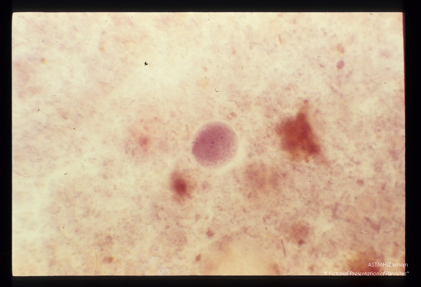 Cysts in stool, showing various numbers of nuclei, hematoxylin stain.