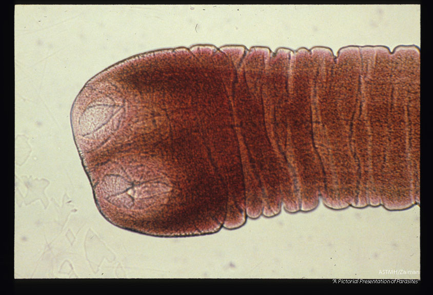 Scolex and neck from a 22 day old experimental infection in a hamster.