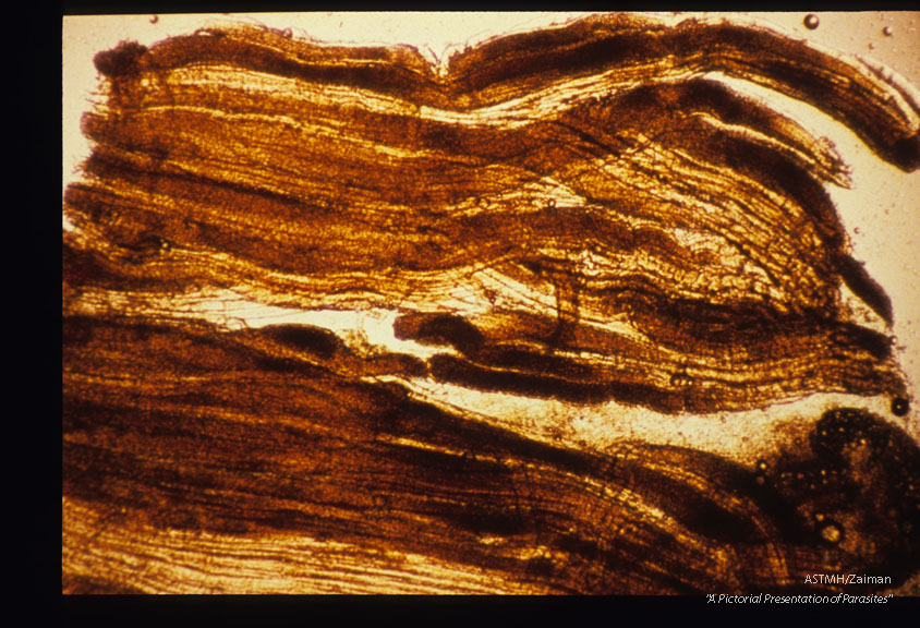 Cysts in muscle of budgerigar. 20 weeks PI.