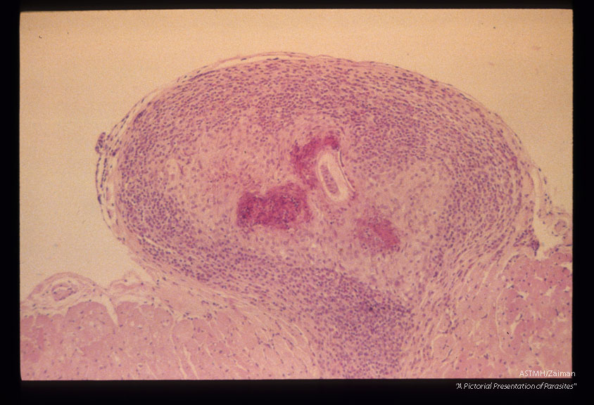 Epicardial granuloma with larva in an infected rabbit.