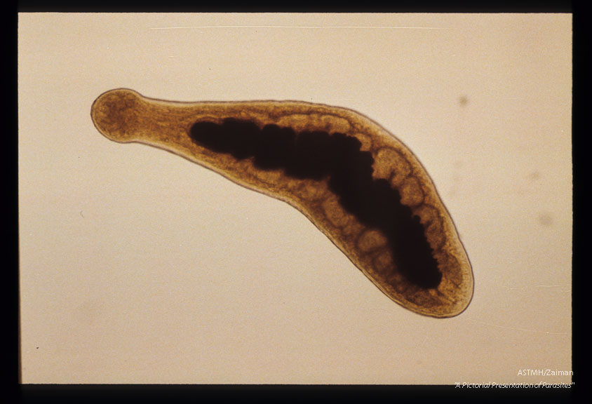 Larval form from muscles of a wild boar.