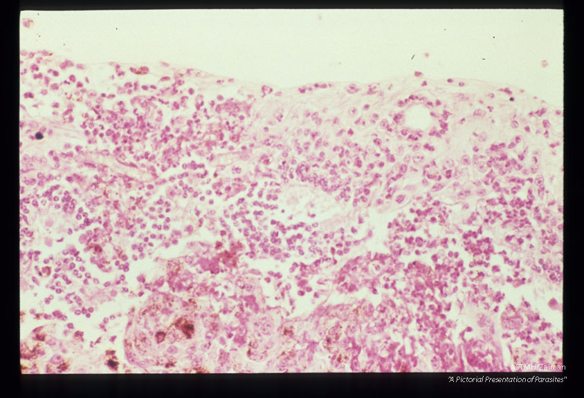 Retinal necrosis, eosinophilic retinitis and vasculitis in an experimentally infected cyncmolgus monkey.