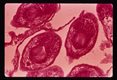 Scolices are seen at higher magnifications.