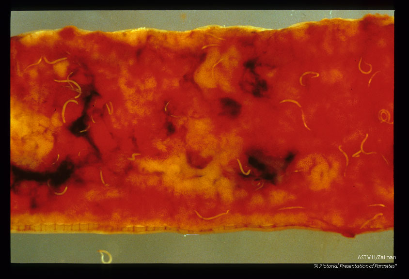 Dog gut showing adults, points of attachment and blood.
