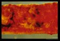 Dog gut showing adults, points of attachment and blood.