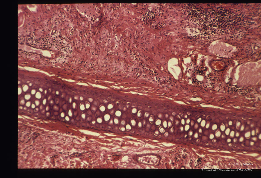 Rabbit ear section, H & E