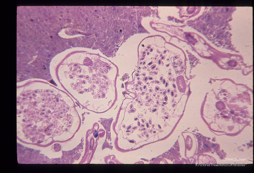 Cross section through adults in appendix.