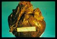 Adult worms in the heart of a harbor seal (Phoca)