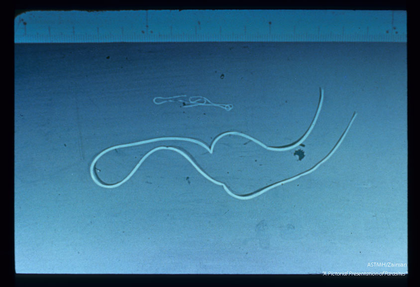 Adult female from canine heart and 112 day old female from "submuscle membrane".