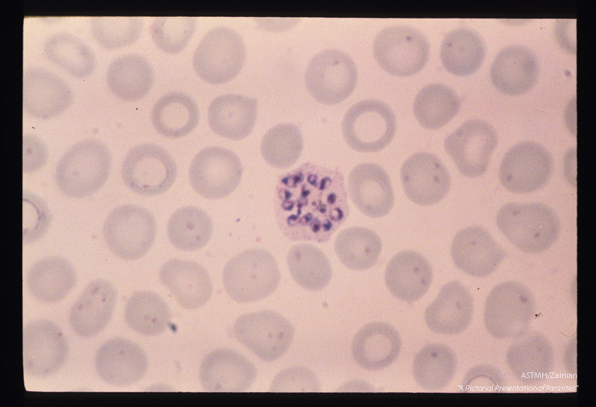 Schizogony from binucleate through multinucleate stages is demonstrated