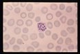 Schizogony from binucleate through multinucleate stages is demonstrated