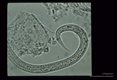 Filariform larva with forked tail.