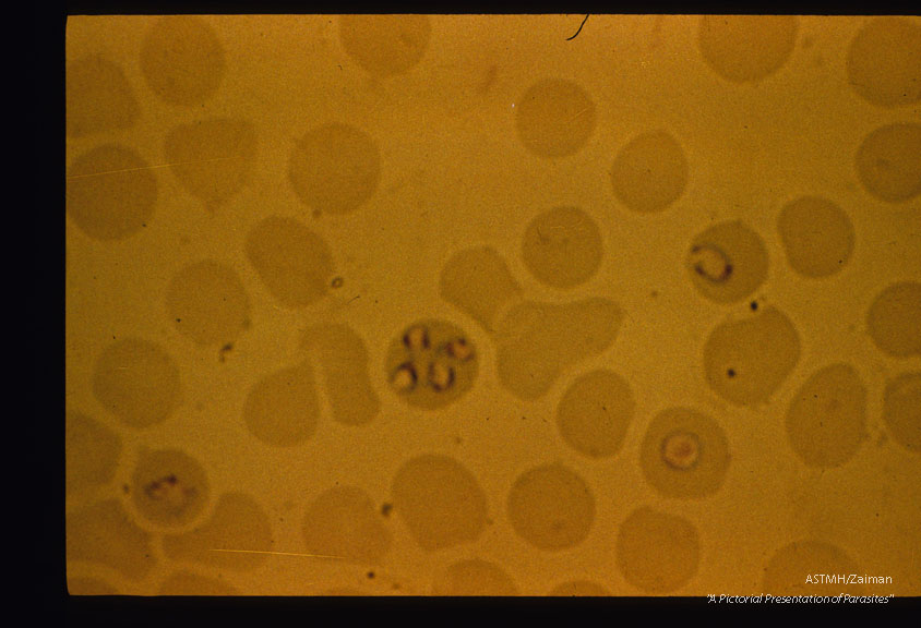 Dog blood smear.