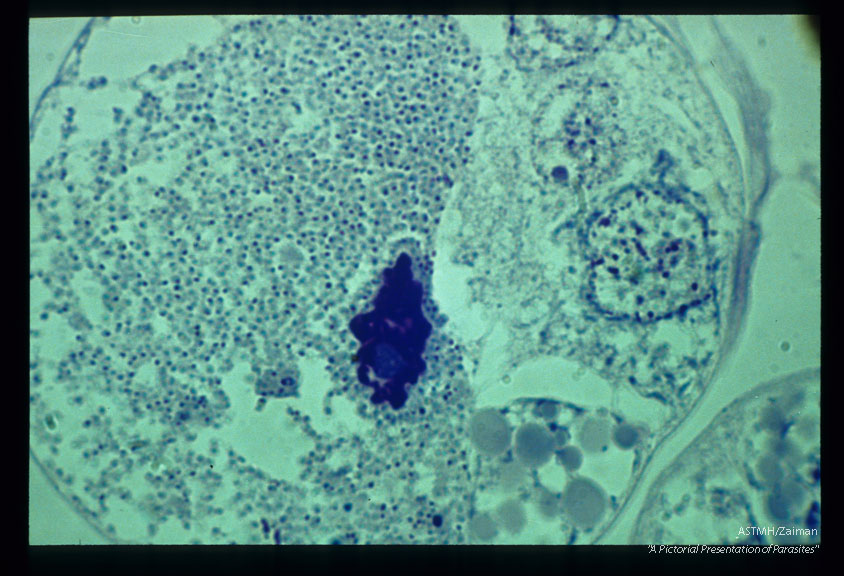 Tick (Rhipicephalus) salivary glands containing Theileria.