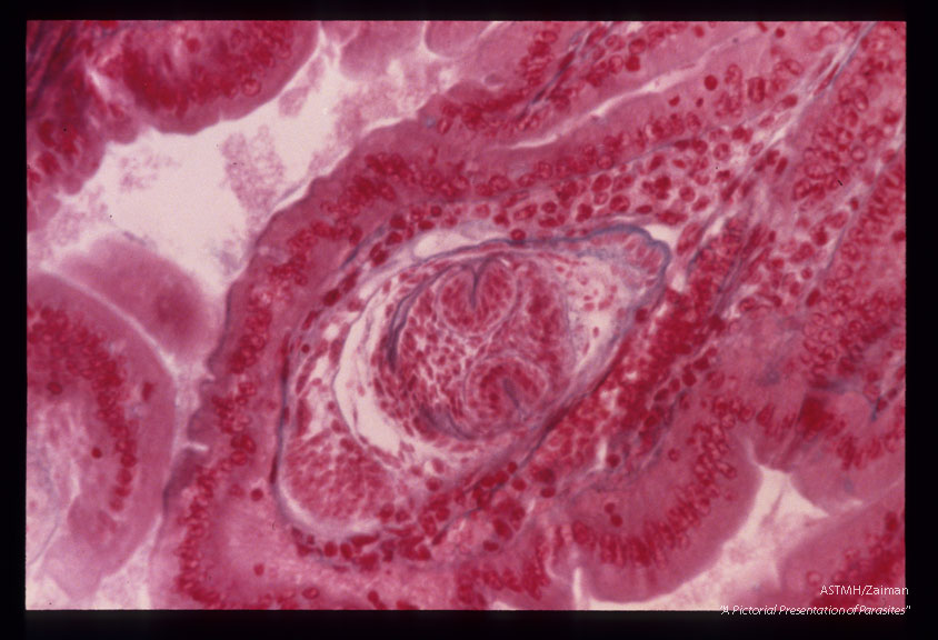 Cysticercoids in villi of a mouse.