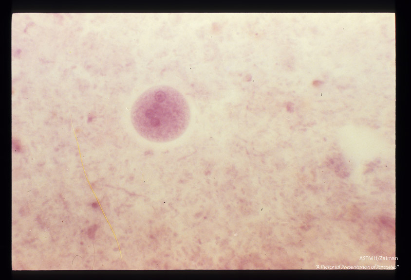 Cysts in stool, showing various numbers of nuclei, hematoxylin stain.