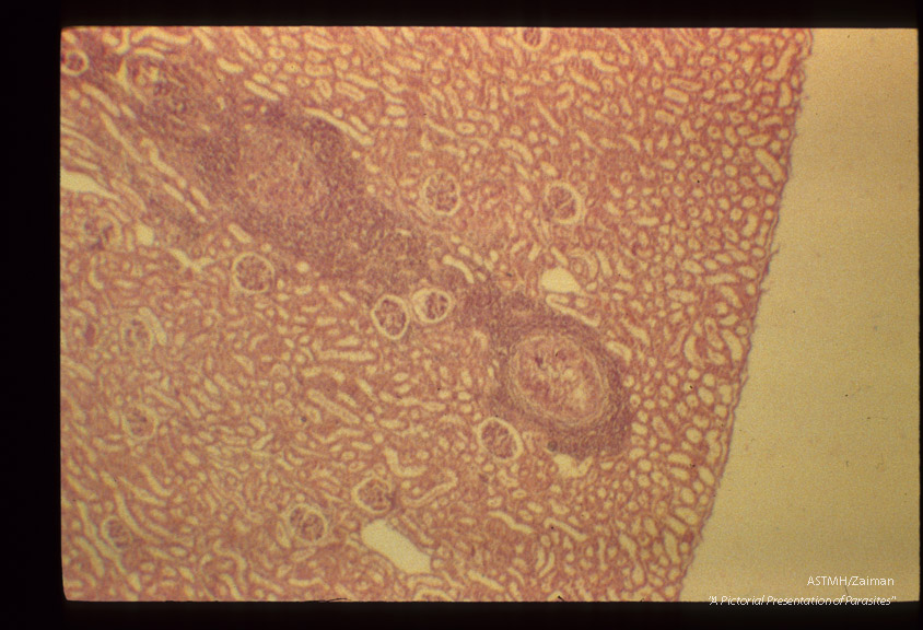 Lesion in dog kidney caused by larva.