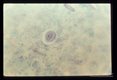 Cyst in stool, trichrome stain.