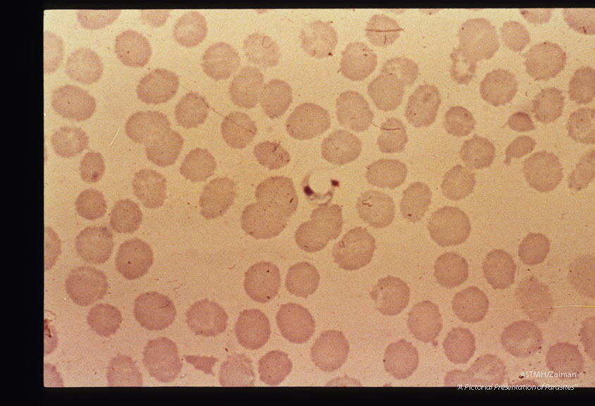 Thin smear of human blood containing a flagellated parasite.