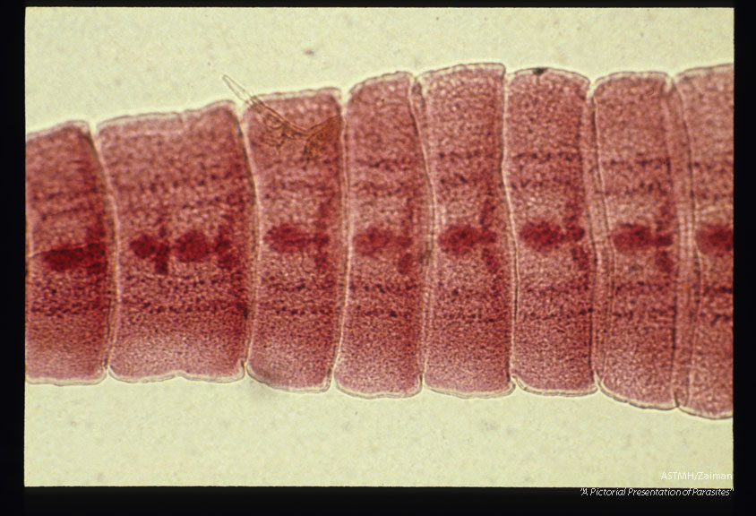 Maturing proglottids one of which shows a tandem duplication of the reproductive system.