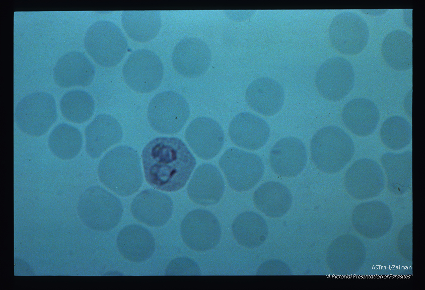 Two young parasites are present in a single erythrocyte.