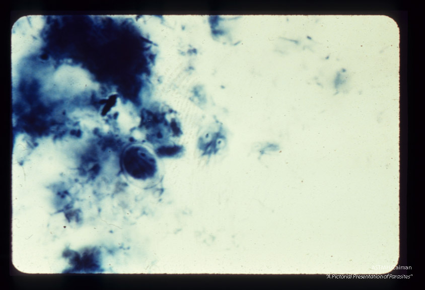 Trophozoite. Iron hematoxylin stain.