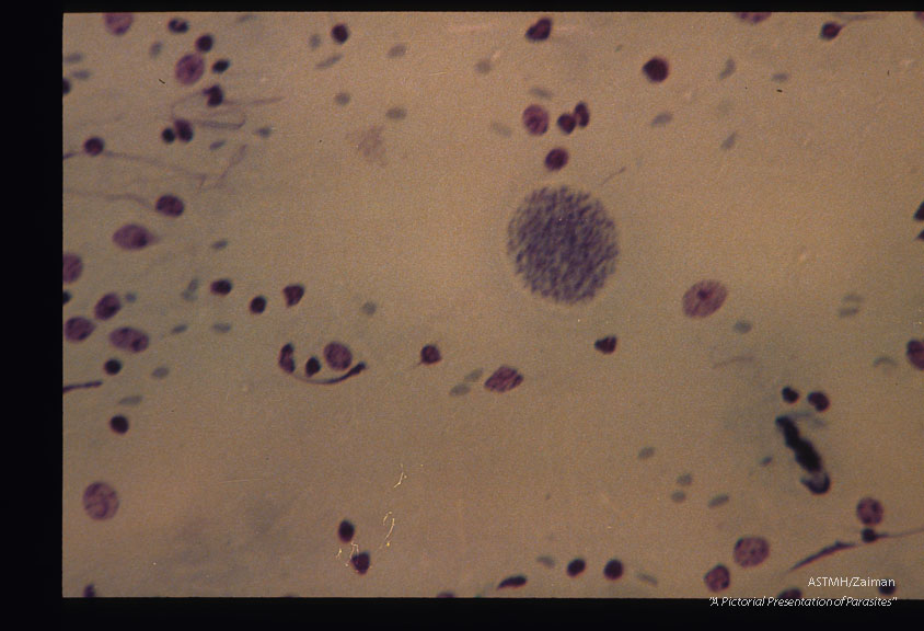 Giemsa stained mouse brain squash. Low and high magnifications.