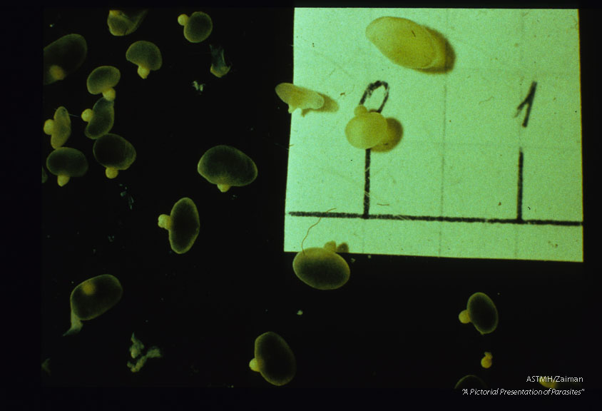 Multiple cysticerci digested free of muscle.