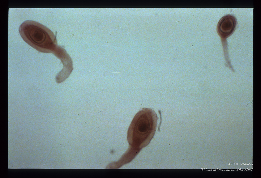 Cysticercoid larvae, from an insect intermediate host.