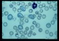 Multiple blood smears from experimental animals infected with material derived from human case.
