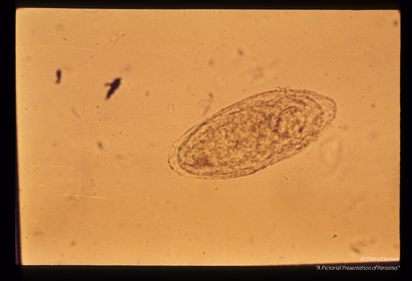 Egg in stool with lateral spine hidden beneath egg mass.