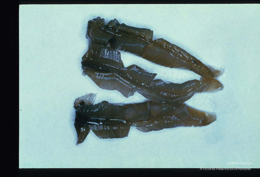 Rows of small white cystic metacercariae are present on the gills removed from the crab Eriocheir japonicus.