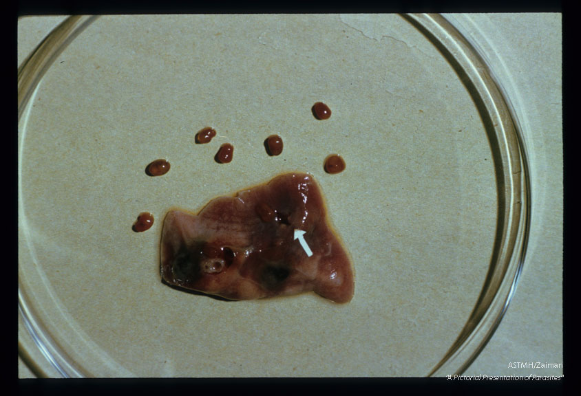 Adult worms separated from a cat lung. A ruptured cyst on the surface of the lung is marked by an arrow.