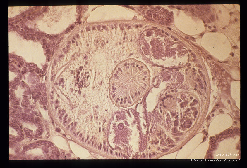 Mesocercarial stage in the adipose tissue of a mouse mammary gland. Note the large, unicellular penetration glands. Low and high magnifications.