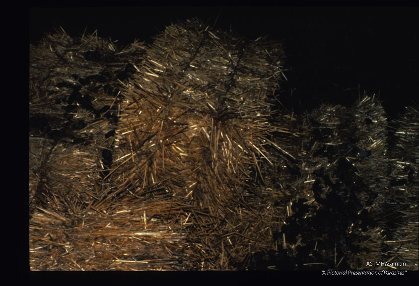 Bales of straw in a midwestern barn contaminated by racoon feces.
