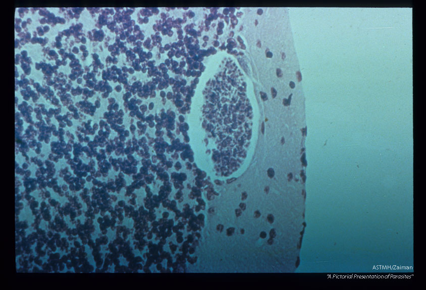 Young cyst from brain of Clethrionomys glareolus. Giemsa Collophoninim.