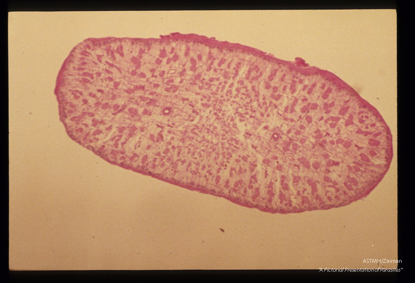 Multiple cross sections through the parasite at various magnifications are presented.