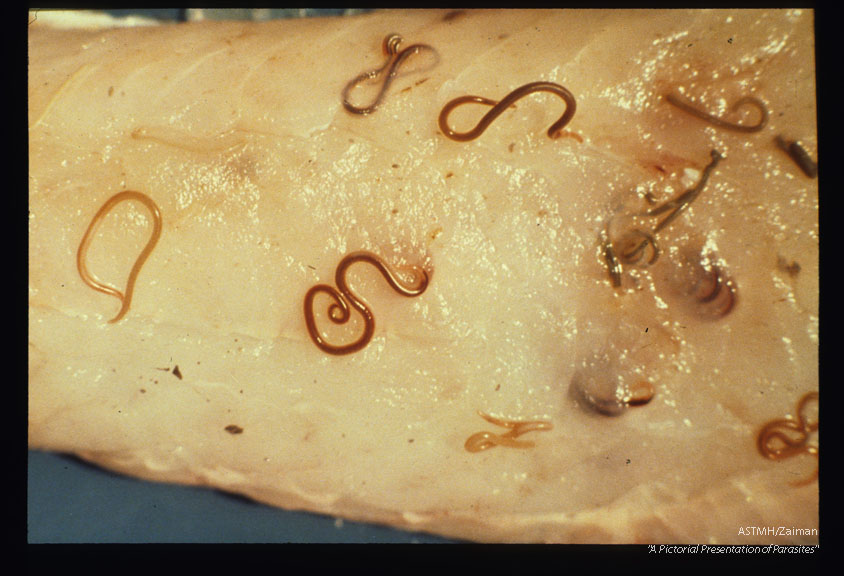 Nematodes in fish flesh and viscera.