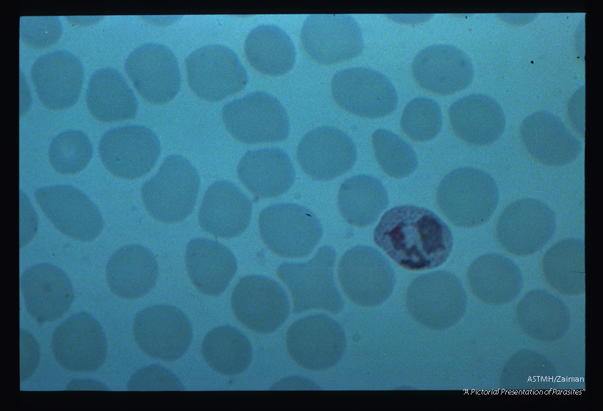 Trophozoites. The irregular dispersion of cytoplasm is evidence of the mobility of the parasite.