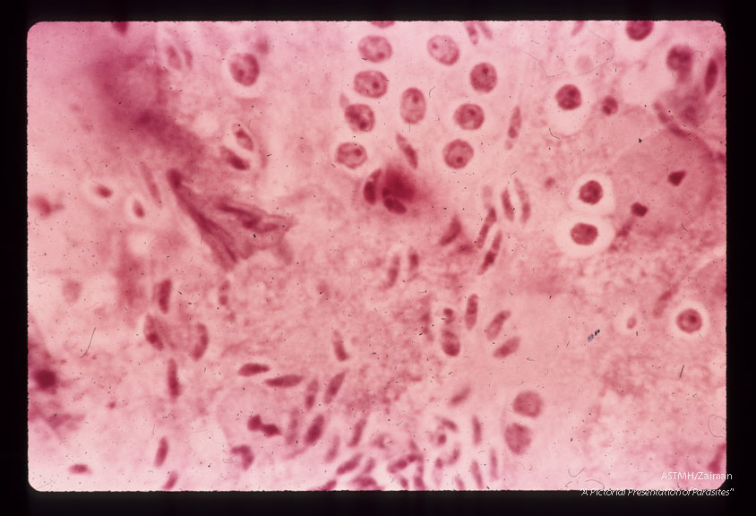 First-generation merozoites and second-generation trophozoites. Note the absence of refractile globules. H & E stain. (72 hr).