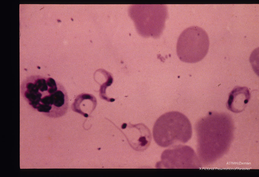 Human blood, thin smear.