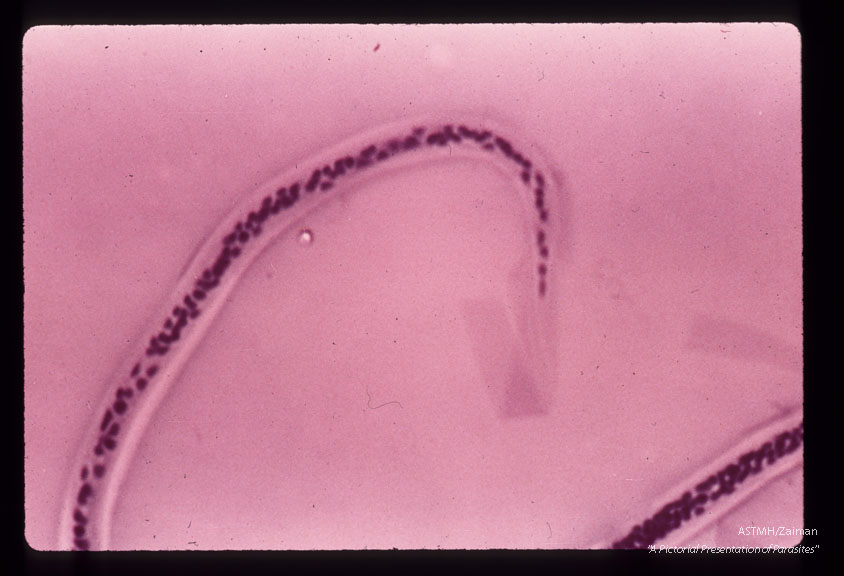 Posterior end of same microfilaria.