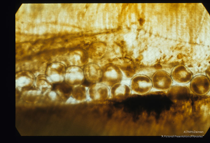 Multiple metacercariae are present on the crab gill.