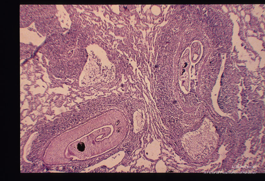 Adults in lung.