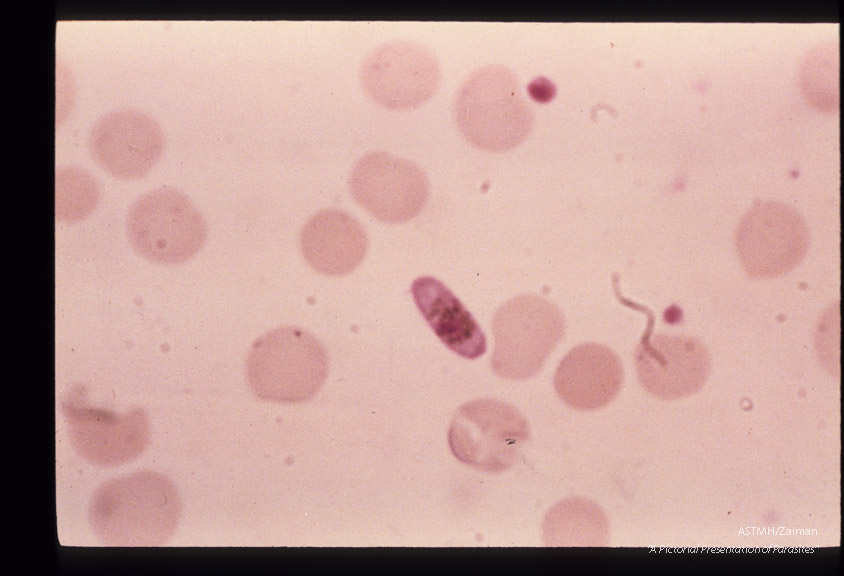 The development of male sexual cells from gametocyte to sperm cells (exflagellation) is shown in this series.